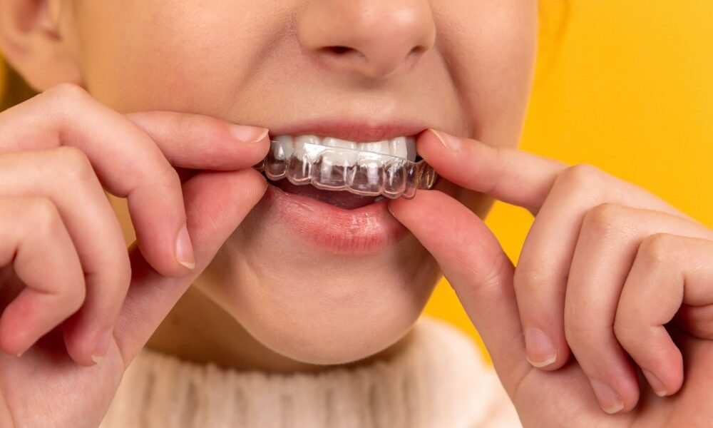 Tips for using invisible aligners in daily life