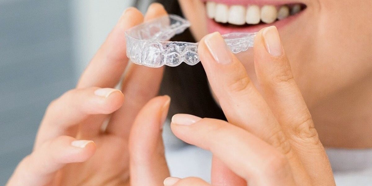 How much do you know about Invisalign London